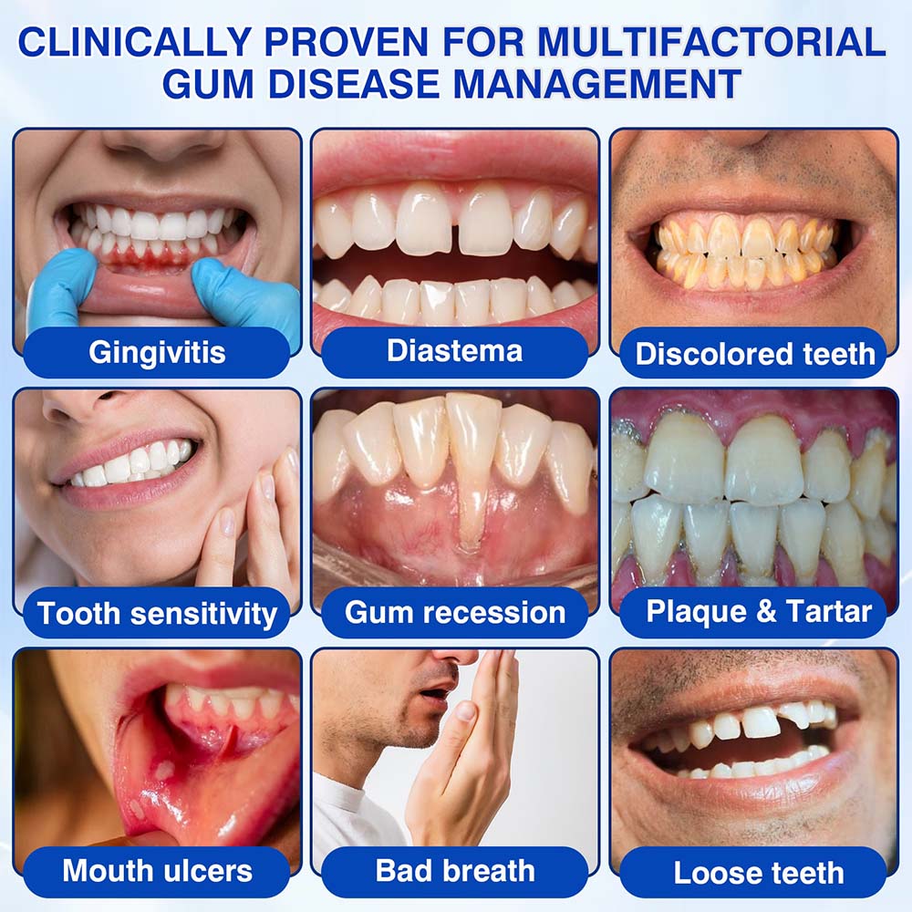 Healrize® GumRevive gel for the regeneration of the tooth-supporting apparatus (for bleeding gums, receding gums, and loose teeth) 🪥🦷1