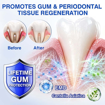 Healrize® GumRevive gel for the regeneration of the tooth-supporting apparatus (for bleeding gums, receding gums, and loose teeth) 🪥🦷1