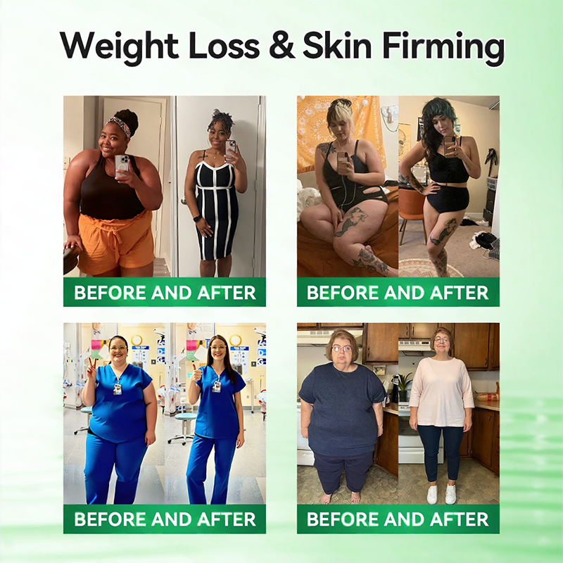 𝑶𝒇𝒇𝒊𝒄𝒊𝒂𝒍 𝑺𝒕𝒐𝒓𝒆👩‍⚕️ |H𝐞a𝐥r𝐢z𝐞® 1𝟐-𝐈N-1 M𝐨r𝐢n𝐠a * B𝐞r𝐛e𝐫i𝐧e * N𝐀D+ 𝐀d𝐯a𝐧c𝐞d N𝐚n𝐨 𝐌i𝐜r𝐨n𝐞e𝐝l𝐞 𝐏a𝐭c𝐡(𝐎𝐧𝐜𝐞 𝐃𝐚𝐢𝐥𝐲, 𝐯𝐢𝐬𝐢𝐛𝐥𝐞 𝐜𝐡𝐚𝐧𝐠𝐞𝐬 𝐢𝐧 𝟕 𝐝𝐚𝐲𝐬）💎F𝐨r 𝐎𝐛𝐞𝐬𝐢𝐭𝐲, 𝐋o𝐨s𝐞 𝐒k𝐢n, 𝐃𝐢𝐚𝐛𝐞𝐭𝐞𝐬, 𝐒𝐥𝐞𝐞𝐩 𝐀𝐩𝐧𝐞𝐚, 𝐀𝐧𝐝 𝐉𝐨𝐢𝐧𝐭 𝐈𝐬𝐬𝐮𝐞𝐬💎