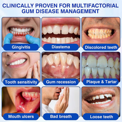 Healrize® GumRevive gel for the regeneration of the tooth-supporting apparatus (for bleeding gums, receding gums, and loose teeth) 🪥🦷1
